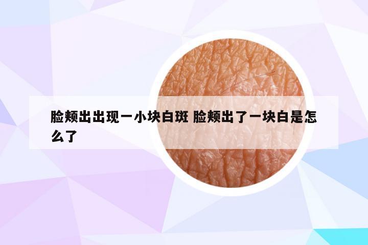 脸颊出出现一小块白斑 脸颊出了一块白是怎么了