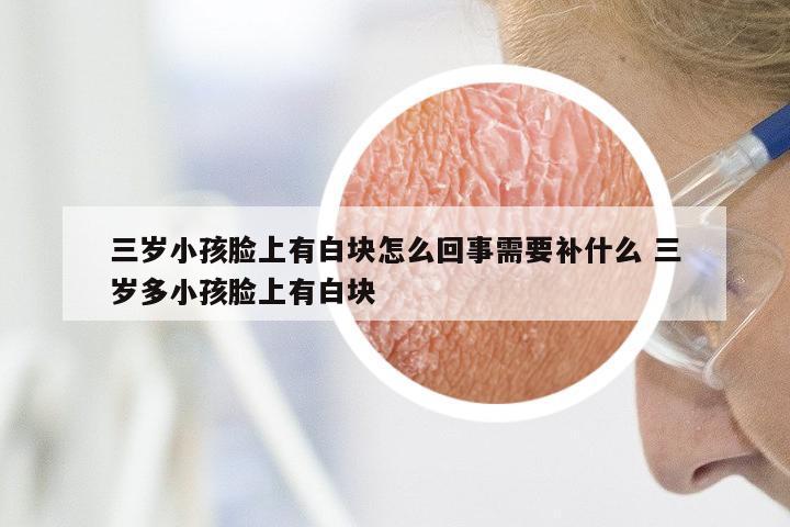 三岁小孩脸上有白块怎么回事需要补什么 三岁多小孩脸上有白块