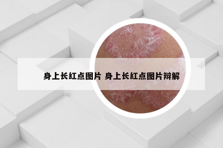 身上长红点图片 身上长红点图片辩解