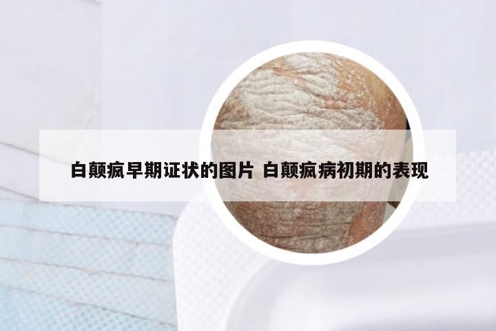 白颠疯早期证状的图片 白颠疯病初期的表现