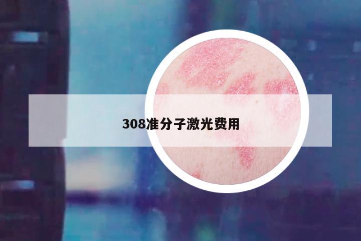 308准分子激光费用
