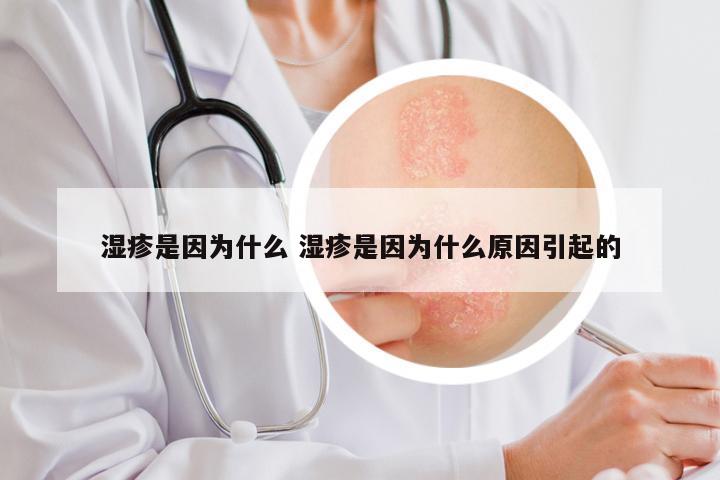 湿疹是因为什么 湿疹是因为什么原因引起的