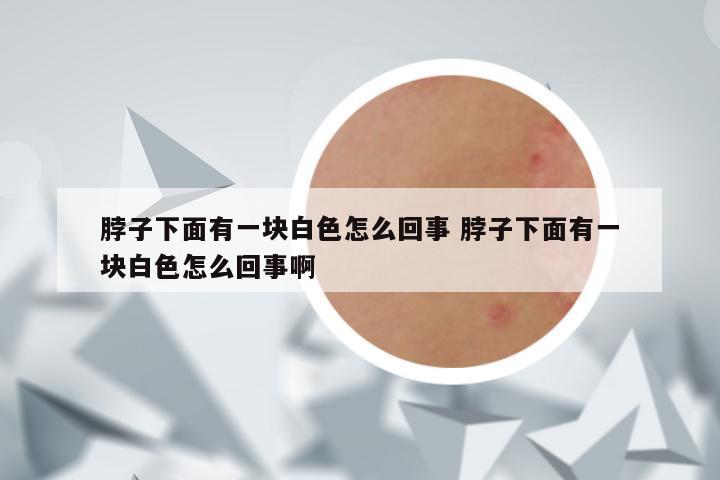 脖子下面有一块白色怎么回事 脖子下面有一块白色怎么回事啊