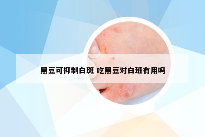 黑豆可抑制白斑 吃黑豆对白班有用吗