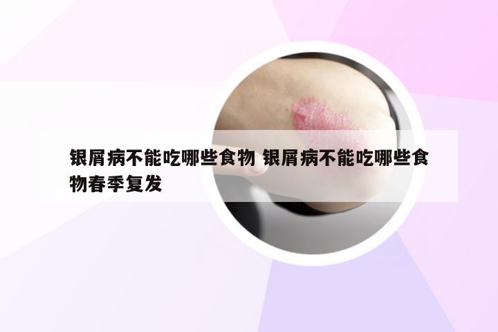 银屑病不能吃哪些食物 银屑病不能吃哪些食物春季复发