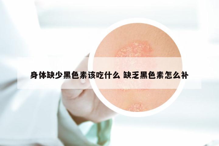 身体缺少黑色素该吃什么 缺乏黑色素怎么补