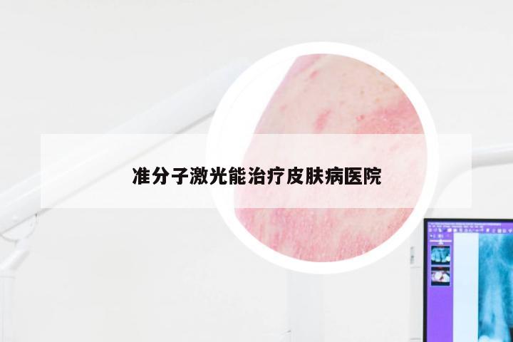 准分子激光能治疗皮肤病医院