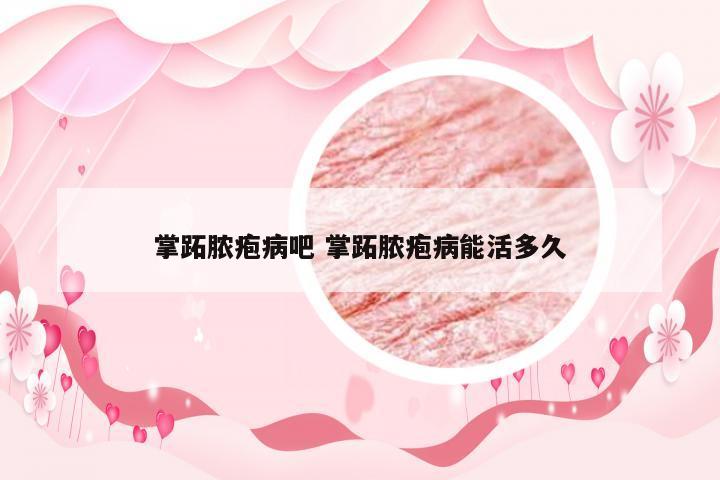掌跖脓疱病吧 掌跖脓疱病能活多久