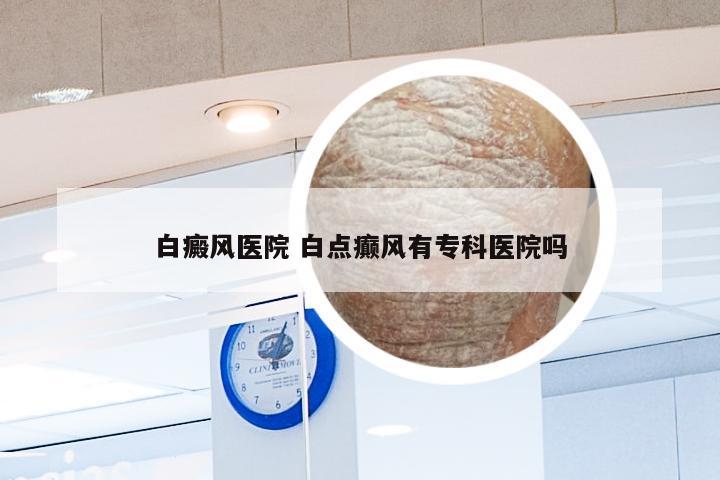 白癜风医院 白点癫风有专科医院吗
