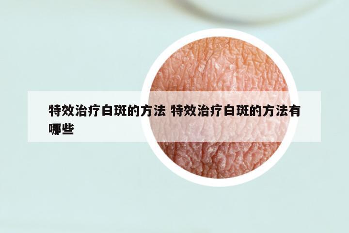 特效治疗白斑的方法 特效治疗白斑的方法有哪些