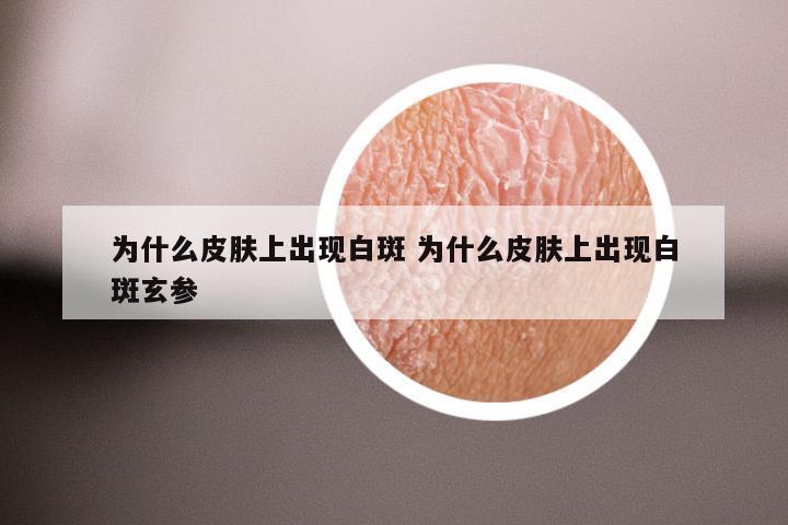 为什么皮肤上出现白斑 为什么皮肤上出现白斑玄参