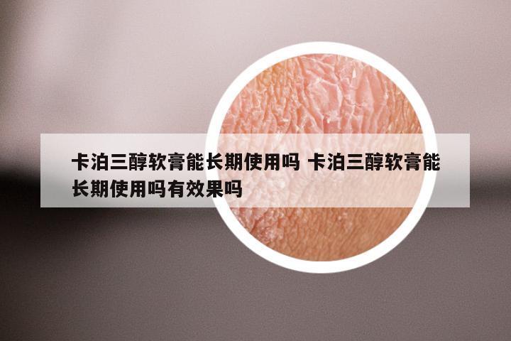 卡泊三醇软膏能长期使用吗 卡泊三醇软膏能长期使用吗有效果吗