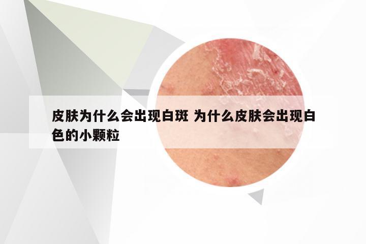皮肤为什么会出现白斑 为什么皮肤会出现白色的小颗粒