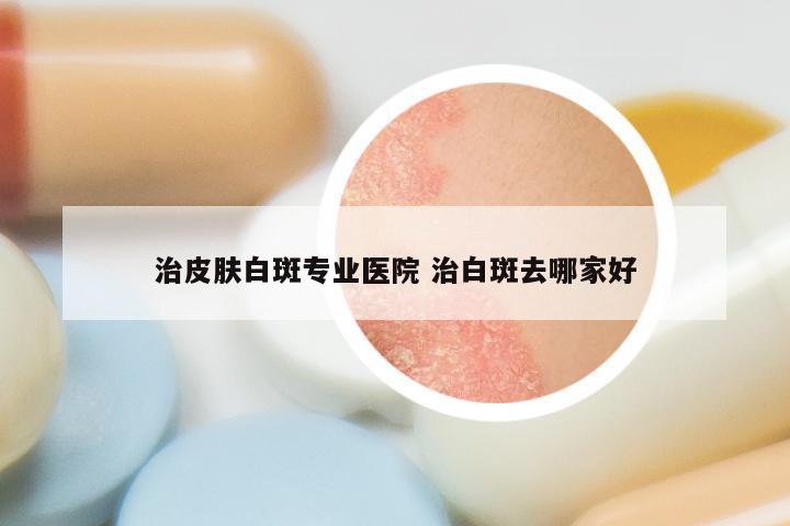 治皮肤白斑专业医院 治白斑去哪家好