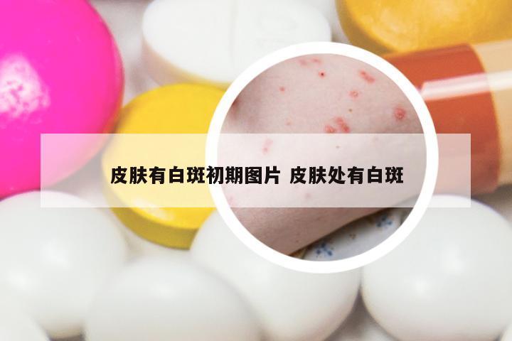 皮肤有白斑初期图片 皮肤处有白斑