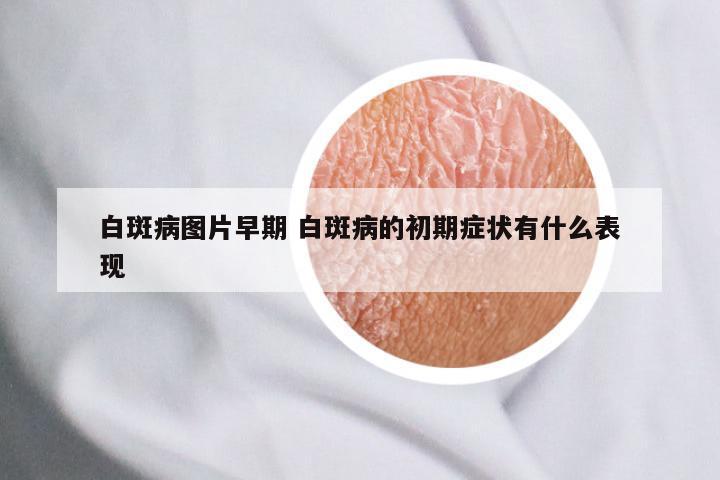 白斑病图片早期 白斑病的初期症状有什么表现