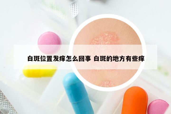 白斑位置发痒怎么回事 白斑的地方有些痒