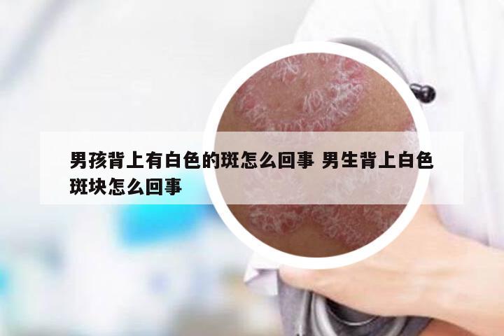 男孩背上有白色的斑怎么回事 男生背上白色斑块怎么回事