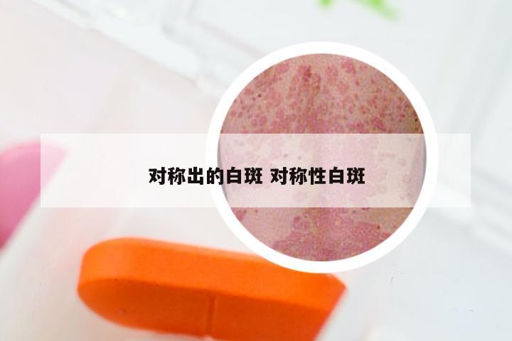 对称出的白斑 对称性白斑