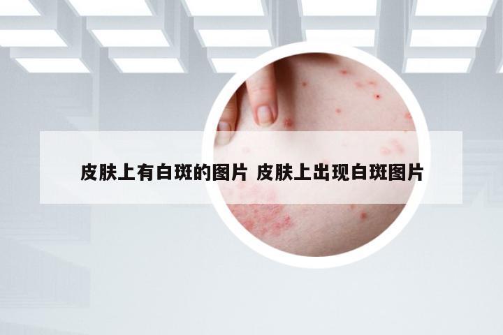 皮肤上有白斑的图片 皮肤上出现白斑图片