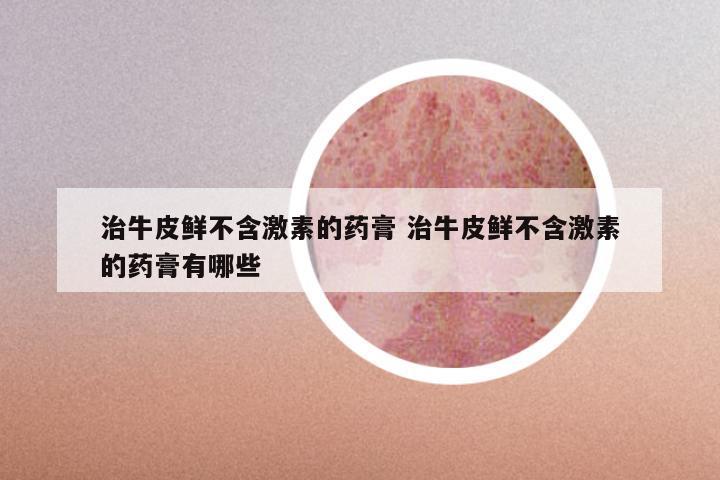 治牛皮鲜不含激素的药膏 治牛皮鲜不含激素的药膏有哪些