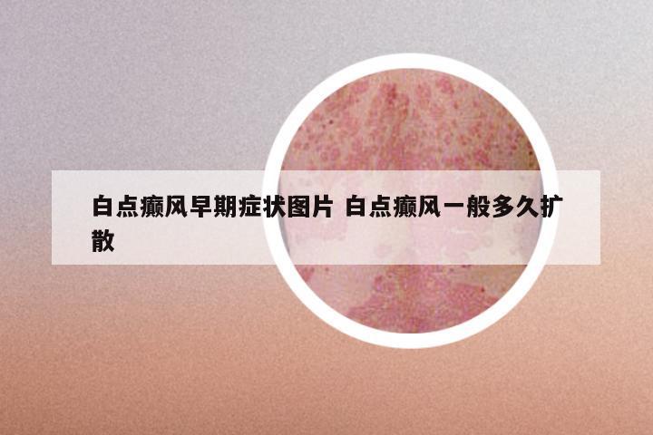 白点癫风早期症状图片 白点癫风一般多久扩散