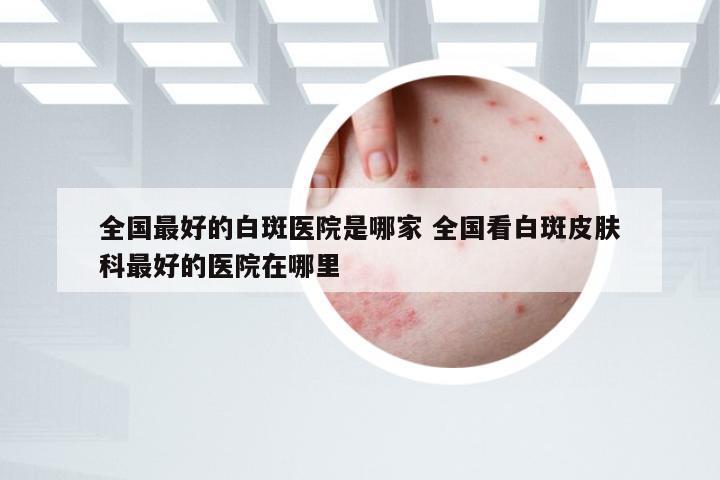 全国最好的白斑医院是哪家 全国看白斑皮肤科最好的医院在哪里