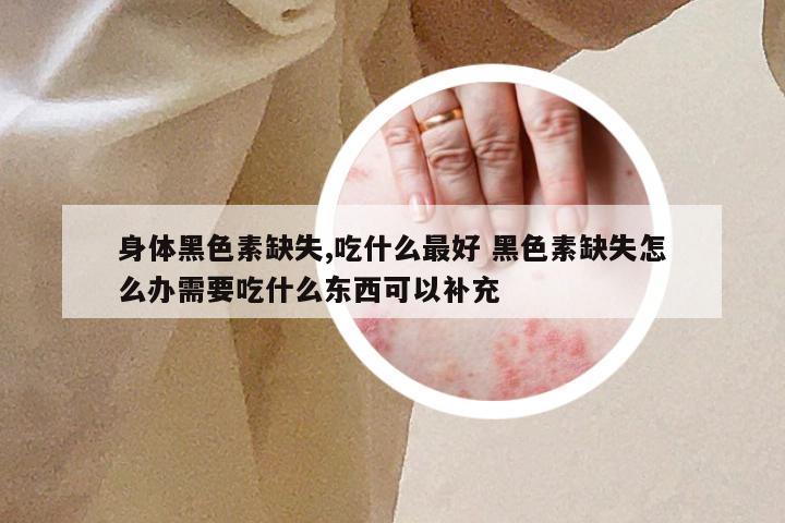 身体黑色素缺失,吃什么最好 黑色素缺失怎么办需要吃什么东西可以补充
