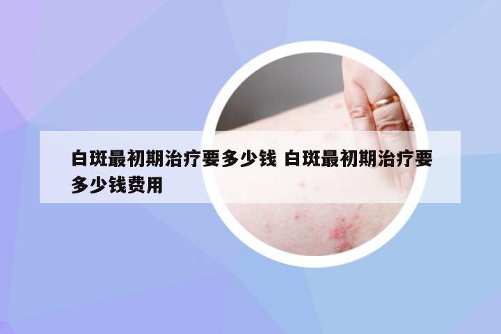 白斑最初期治疗要多少钱 白斑最初期治疗要多少钱费用