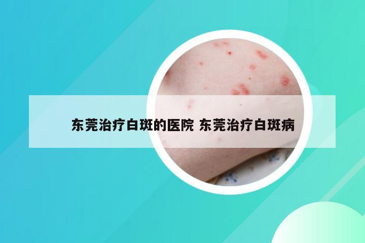 东莞治疗白斑的医院 东莞治疗白斑病
