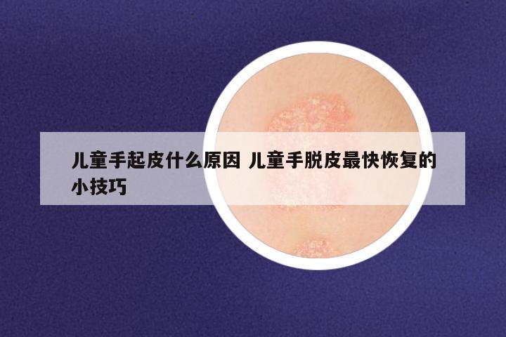 儿童手起皮什么原因 儿童手脱皮最快恢复的小技巧