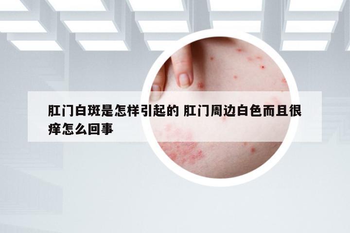 肛门白斑是怎样引起的 肛门周边白色而且很痒怎么回事