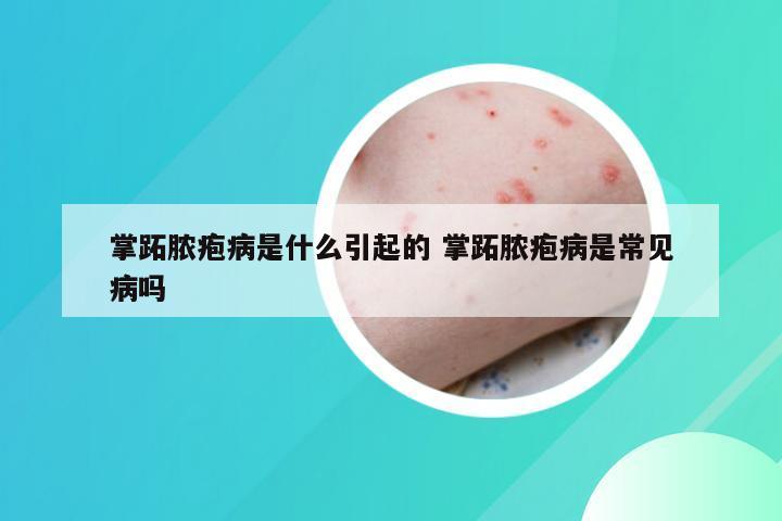 掌跖脓疱病是什么引起的 掌跖脓疱病是常见病吗