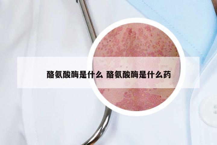 酪氨酸酶是什么 酪氨酸酶是什么药