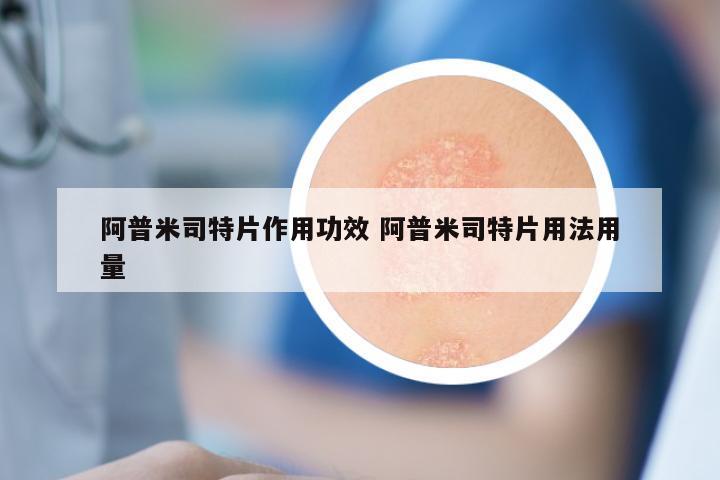 阿普米司特片作用功效 阿普米司特片用法用量