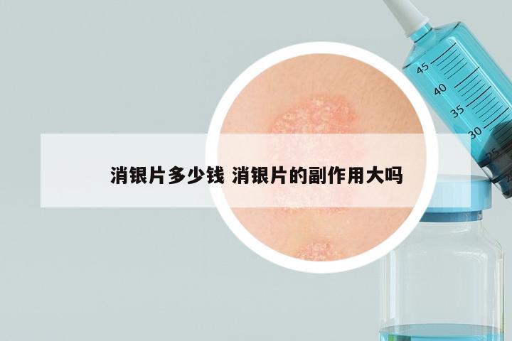 消银片多少钱 消银片的副作用大吗