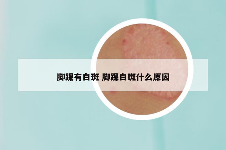 脚踝有白斑 脚踝白斑什么原因