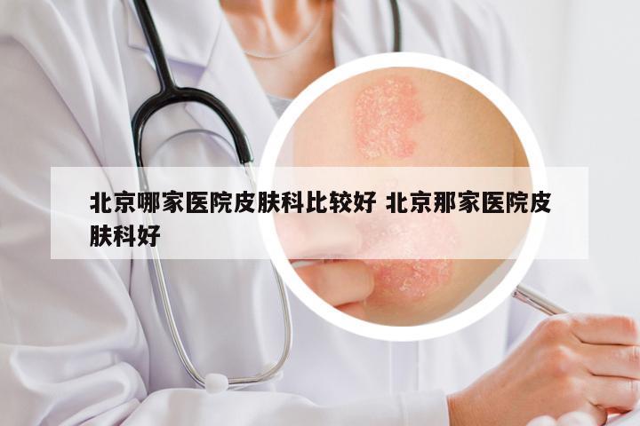 北京哪家医院皮肤科比较好 北京那家医院皮肤科好