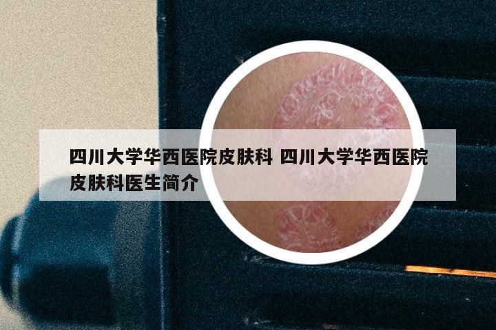 四川大学华西医院皮肤科 四川大学华西医院皮肤科医生简介