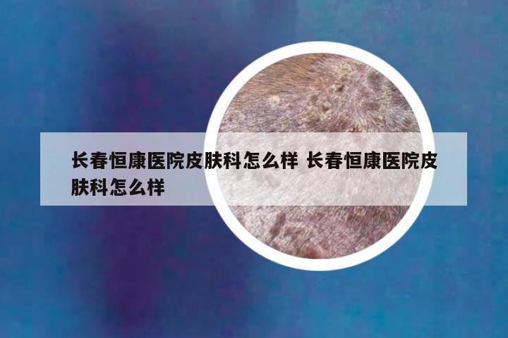 长春恒康医院皮肤科怎么样 长春恒康医院皮肤科怎么样
