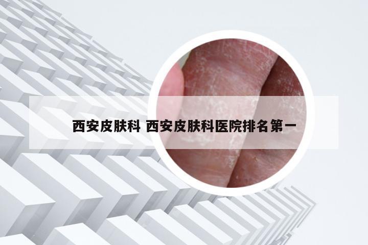 西安皮肤科 西安皮肤科医院排名第一