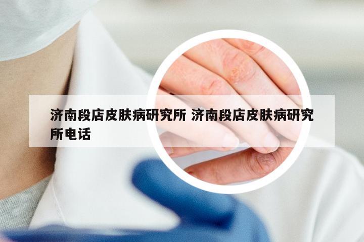 济南段店皮肤病研究所 济南段店皮肤病研究所电话