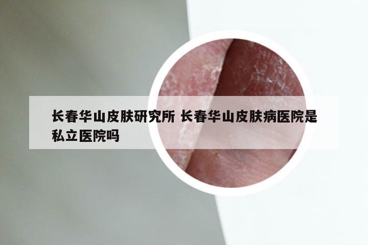 长春华山皮肤研究所 长春华山皮肤病医院是私立医院吗