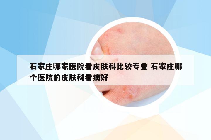 石家庄哪家医院看皮肤科比较专业 石家庄哪个医院的皮肤科看病好