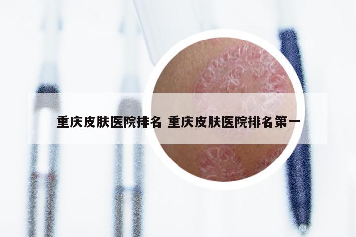 重庆皮肤医院排名 重庆皮肤医院排名第一