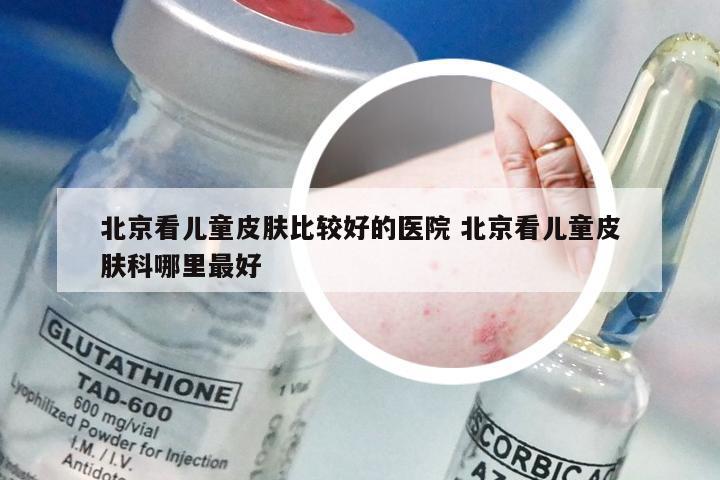 北京看儿童皮肤比较好的医院 北京看儿童皮肤科哪里最好
