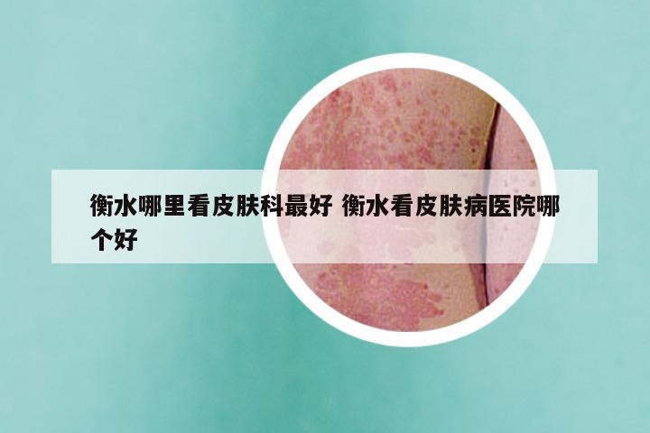 衡水哪里看皮肤科最好 衡水看皮肤病医院哪个好