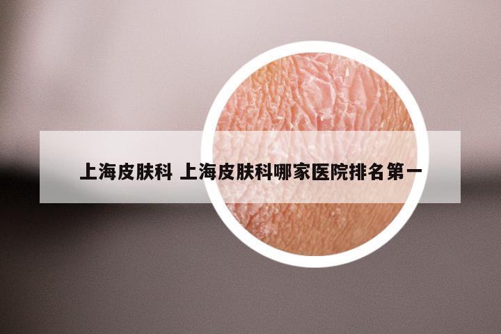 上海皮肤科 上海皮肤科哪家医院排名第一