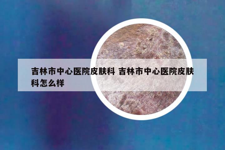 吉林市中心医院皮肤科 吉林市中心医院皮肤科怎么样