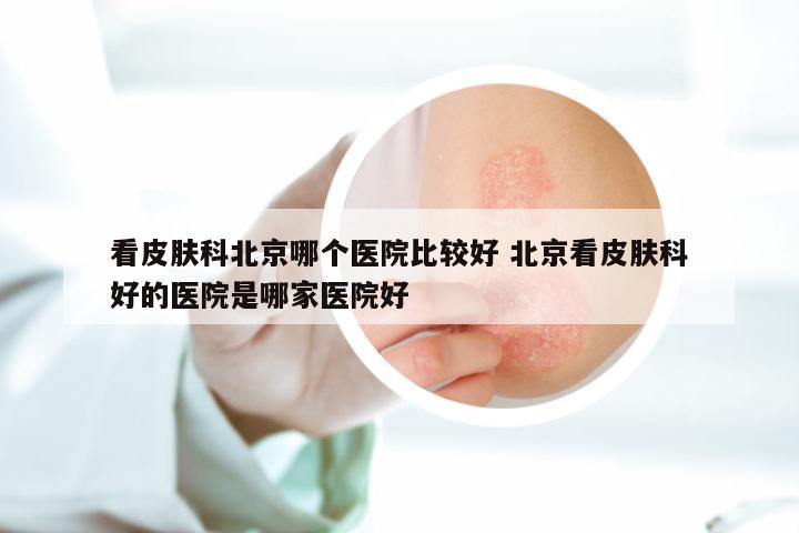 看皮肤科北京哪个医院比较好 北京看皮肤科好的医院是哪家医院好